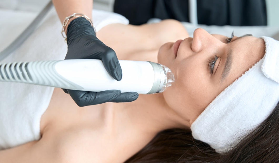 Microneedling Radiofrequenz