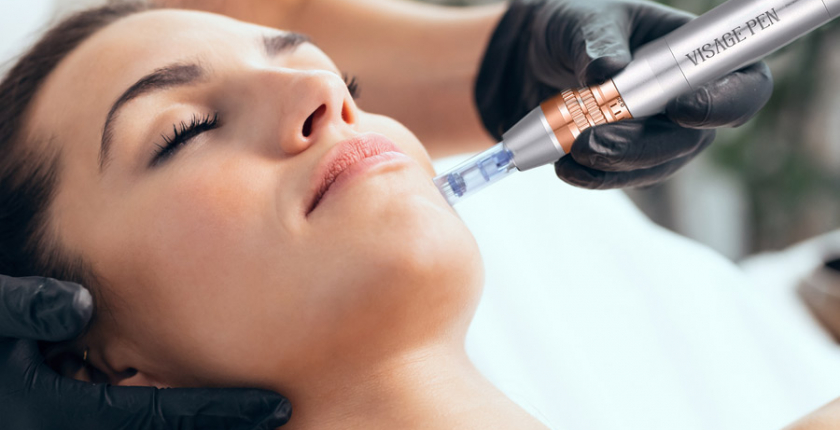 Microneedling